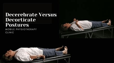 decerebrate  decorticate postures mobile physiotherapy clinic