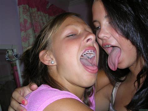 teen braces with cum on them photo album by islandtime xvideos