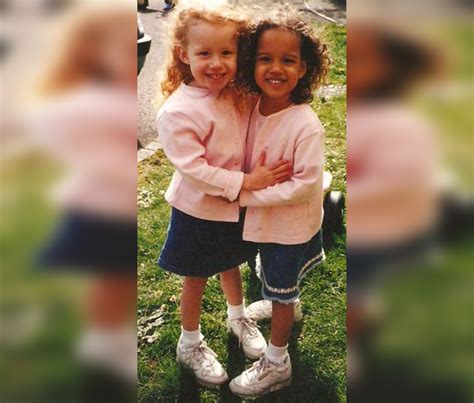 world s only biracial twins are now grown up daily spikes