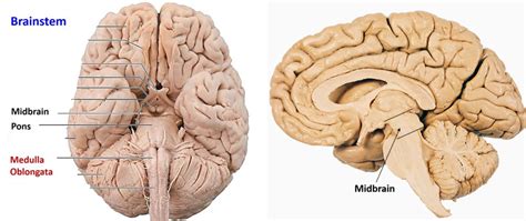 midbrain anatomy anatomy qa