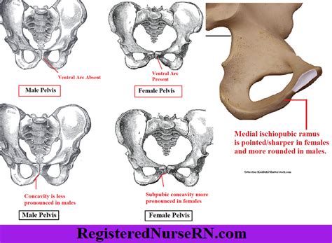 Male Vs Female Pelvis Differences Anatomy Of Skeleton