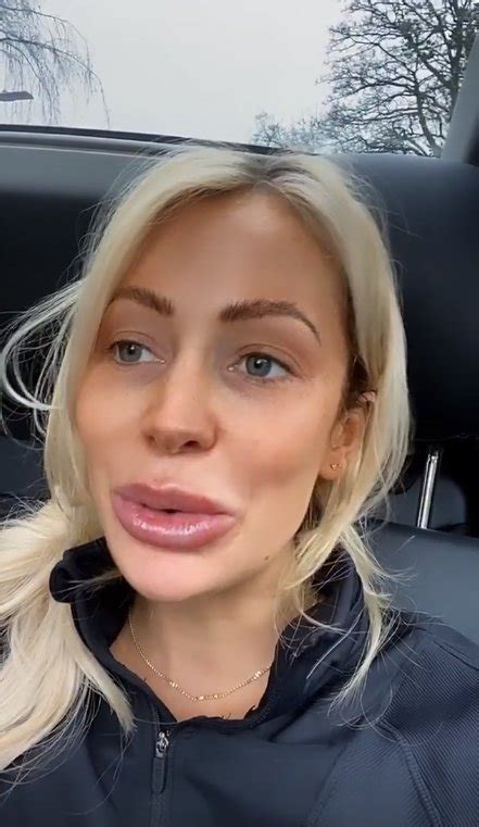 olivia attwood fine with her mouth looking like a swollen b hole