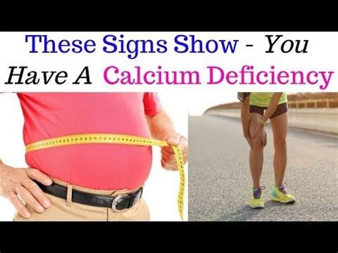 calcium deficiency symptoms  signs     ignore calcium deficiency