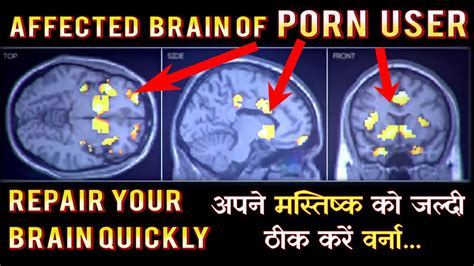 nobody tells you to repair affected brain after porn addicted दिमाग