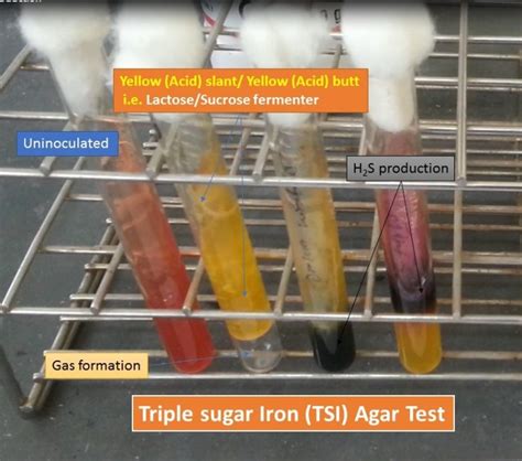 triple sugar iron  test composition principle procedure result