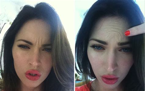 Megan Fox Plastic Surgery Before And After Botox Injection