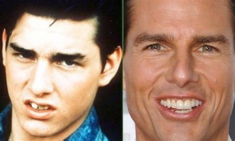 tom cruise teeth symmetry 10 celebrities with asymmetrical faces why