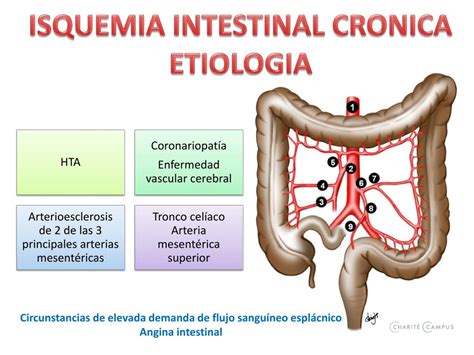 isquemia intestinal