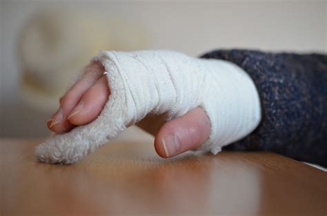 handgelenk gebrochen dauer wissenswertes zum handgelenkbruch