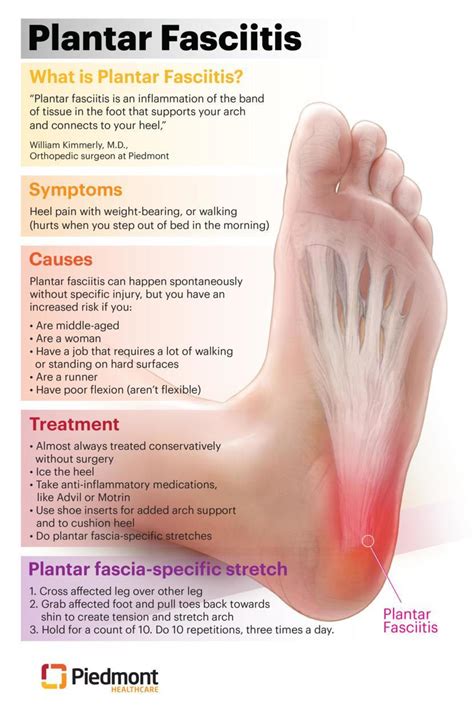 Plantar Fasciitis Heel Spur Syndrome