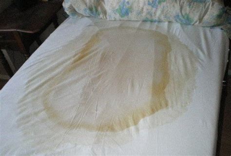 pin on bed wetting
