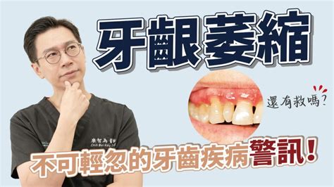 Youtube新影片！牙齦萎縮不可逆 一旦不留意，就踏上牙齒鬆動之路