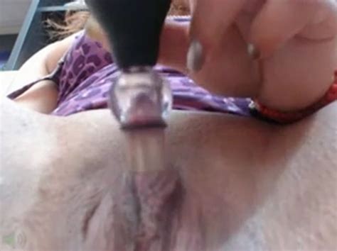 forumophilia porn forum vacuum pumping pussy huge pussylips monster clit page 18