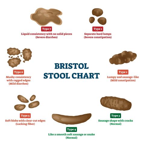 stool color chart stool chart mucus color mucus  stool filling   stool color chart