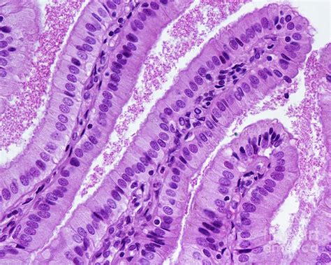 simple columnar epithelium photograph  jose calvo science photo