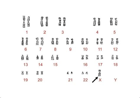 File Karyotype  Embryology