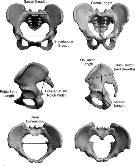 Pelvic Bone Anatomy Male And Female Pelvis The Bony Pelvis Pelvic