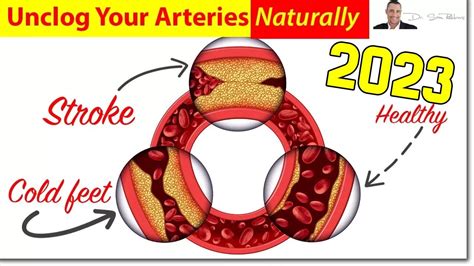 clinically proven ways  unclog clean  arteries naturally