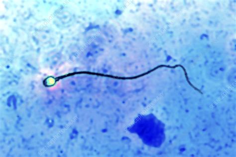 sperm cell light micrograph stock image p624 0190 science photo