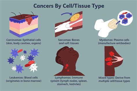 types  cancer    differ