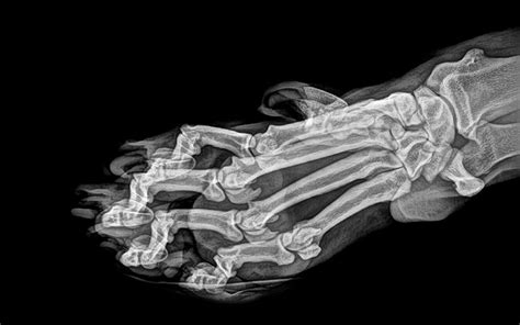 Cat Paw X Ray Meme Cat Meme Stock Pictures And Photos