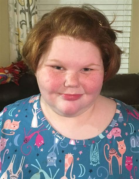 alexis shapiro texas girl who faced extreme weight gain is doing