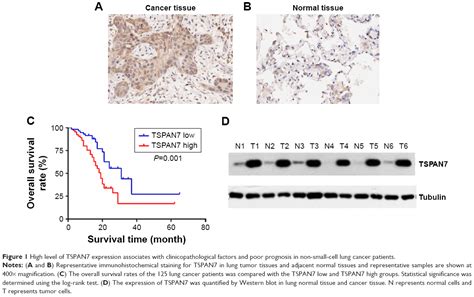 Tspan7 Promotes The Migration And Proliferation Of Lung Cancer Cells V