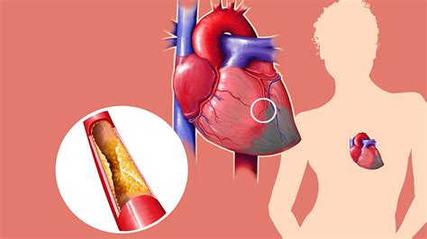 10 surprising facts about cholesterol everyday health