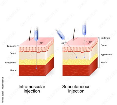 intramuscular injection  subcutaneous injection stock vector adobe