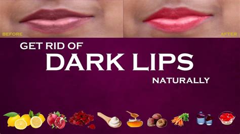 get rid of dark lips naturally easy home remedies youtube