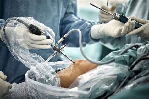 arthroscopic knee surgery complications