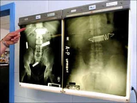 the weirdest xrays ever 18 pics curious funny photos pictures