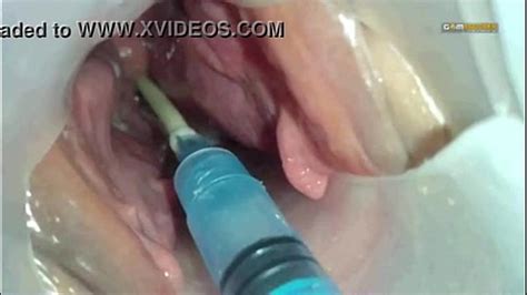 sperm injected into the uterus of the wife of others xnxx