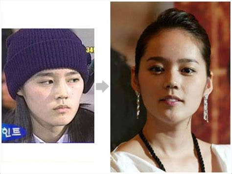 Korean Stars Without Plastic Surgery Naturally No Surgery