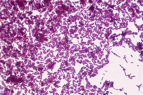 Bacillus Gram Positive Stain Under The Microscope View