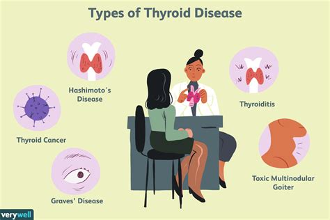 thyroid disease   risk factors