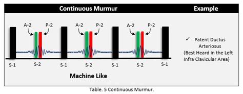 Heart Sounds Murmurs Epomedicine