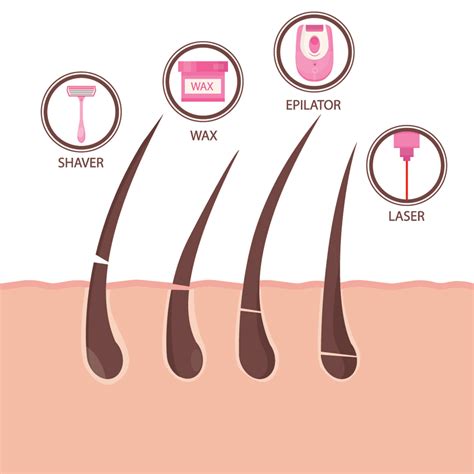 questions     laser hair removal louisville laser
