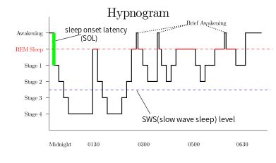 rapid eye movement sleep wikipedia