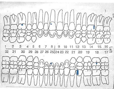 tooth chart  numbers  surfaces