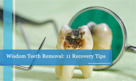 wisdom teeth removal  recovery tips
