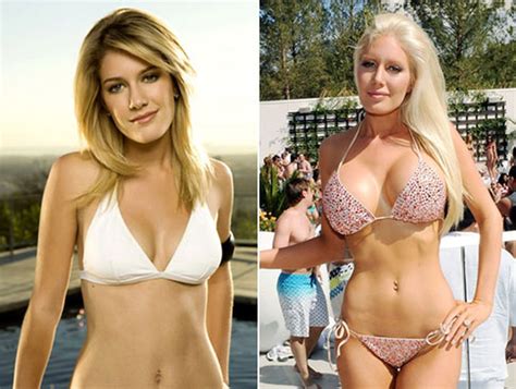 alleged sex tape spencer pratt selling will show heidi montag before and after surgery report
