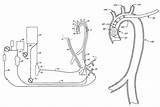 Patent Patents Cardiopulmonary Bypass Patenten Afbeeldingen Google sketch template