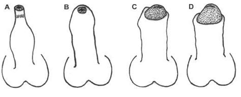 Sex penus type