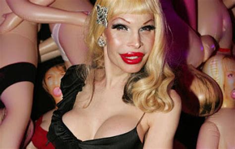 10 Craziest Plastic Surgeries You Have To See To Believe