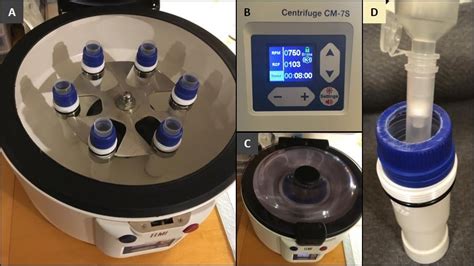 diy centrifugation based purification of cfdna