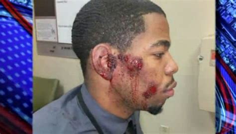 st louis police beat wrong black man hellobeautiful