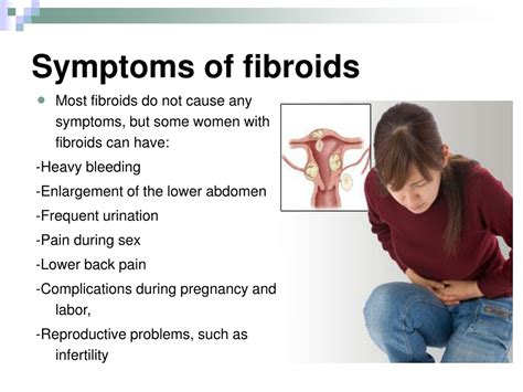 Ppt Uterine Femoral Fibroid Embolization Powerpoint Presentation