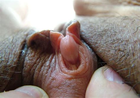 deformed clitoris mega porn pics