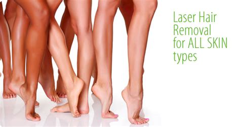 Laser Hair Removal In Buffalo Grove Il